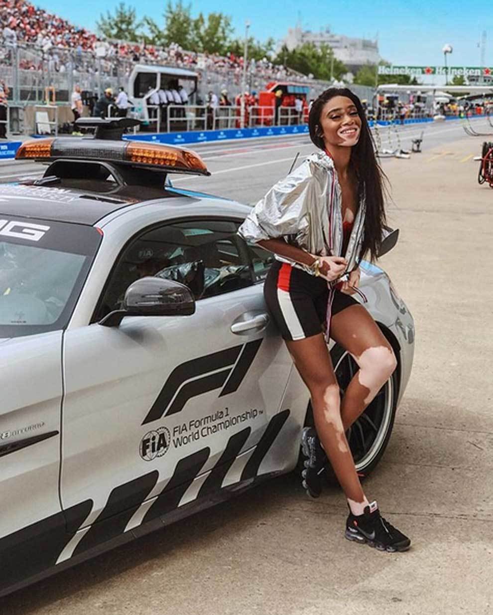 GP Canadá F1 2018: Model Winnie Harlow who botched up at the Canada GP -  Foto 13 de 16 | MARCA English